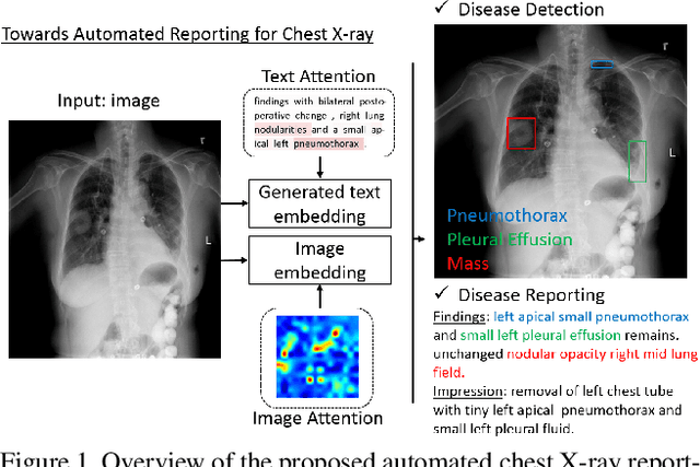 Figure 1 for TieNet: Text-Image Embedding Network for Common Thorax Disease Classification and Reporting in Chest X-rays