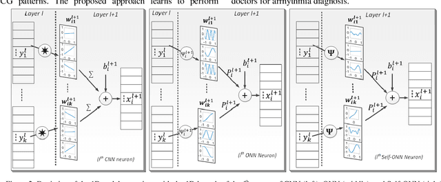 Figure 2 for Blind ECG Restoration by Operational Cycle-GANs