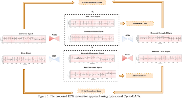 Figure 4 for Blind ECG Restoration by Operational Cycle-GANs
