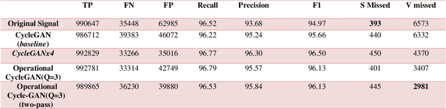 Figure 3 for Blind ECG Restoration by Operational Cycle-GANs