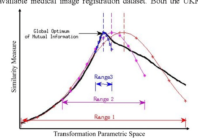 Figure 1 for A Distance Oriented Kalman Filter Particle Swarm Optimizer Applied to Multi-Modality Image Registration