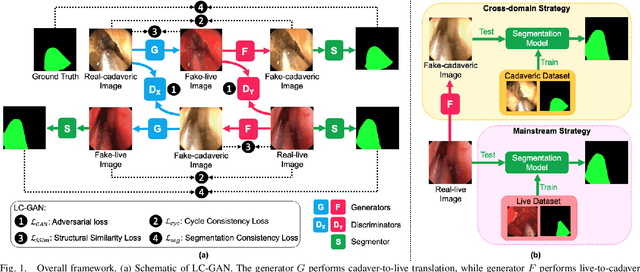 Figure 1 for LC-GAN: Image-to-image Translation Based on Generative Adversarial Network for Endoscopic Images