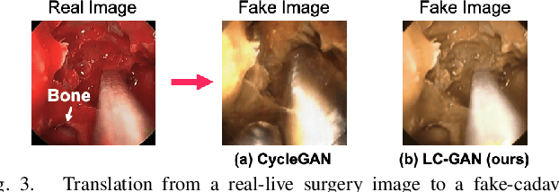 Figure 3 for LC-GAN: Image-to-image Translation Based on Generative Adversarial Network for Endoscopic Images