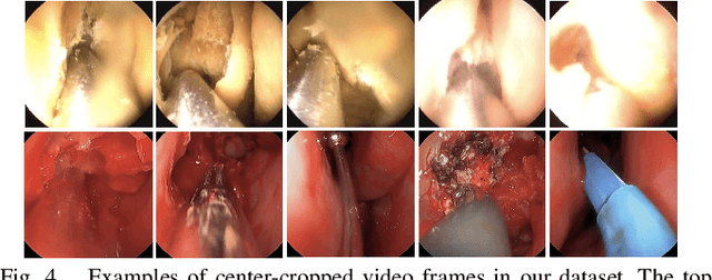 Figure 4 for LC-GAN: Image-to-image Translation Based on Generative Adversarial Network for Endoscopic Images