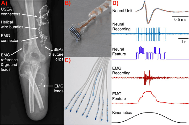 Figure 2 for Intuitive Neuromyoelectric Control of a Dexterous Bionic Arm Using a Modified Kalman Filter