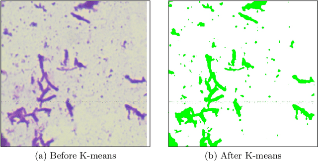 Figure 1 for Semi-Automatic Labeling and Semantic Segmentation of Gram-Stained Microscopic Images from DIBaS Dataset