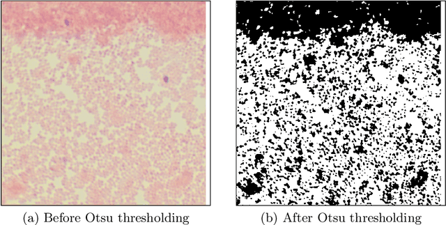 Figure 3 for Semi-Automatic Labeling and Semantic Segmentation of Gram-Stained Microscopic Images from DIBaS Dataset