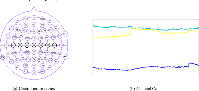 Figure 2 for Mu-suppression detection in motor imagery electroencephalographic signals using the generalized extreme value distribution