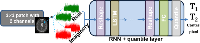 Figure 1 for RinQ Fingerprinting: Recurrence-informed Quantile Networks for Magnetic Resonance Fingerprinting