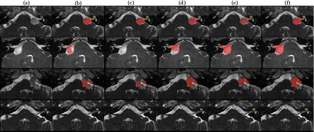 Figure 2 for Unsupervised Cross-Modality Domain Adaptation for Segmenting Vestibular Schwannoma and Cochlea with Data Augmentation and Model Ensemble