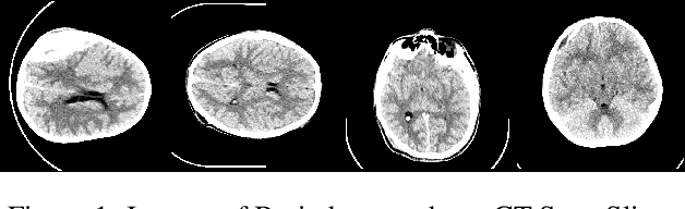 Figure 1 for A Graphical Approach For Brain Haemorrhage Segmentation