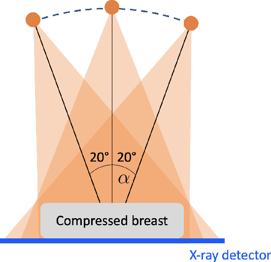 Figure 1 for Learning a microlocal priorfor limited-angle tomography