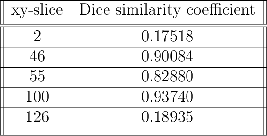 Figure 2 for Learning a microlocal priorfor limited-angle tomography