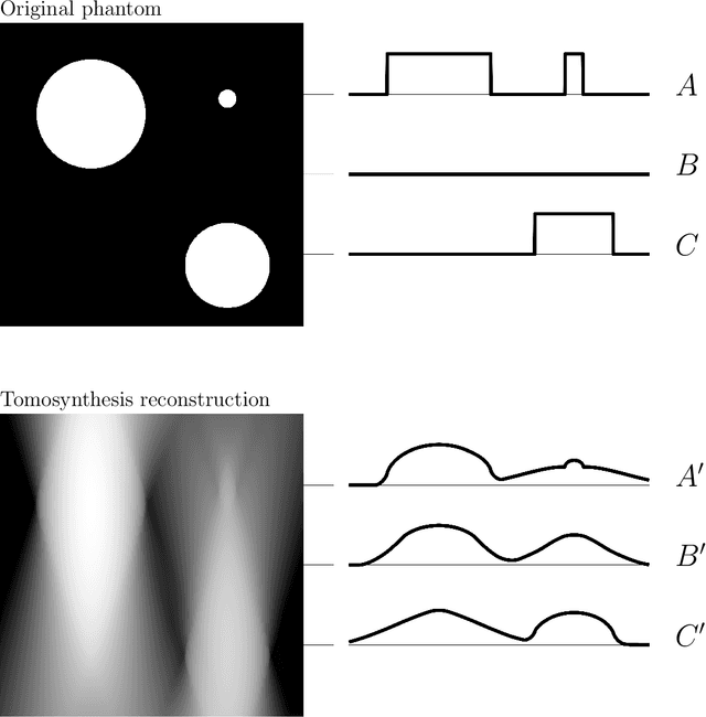 Figure 3 for Learning a microlocal priorfor limited-angle tomography