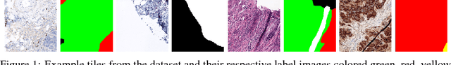 Figure 1 for Generalizing multistain immunohistochemistry tissue segmentation using one-shot color deconvolution deep neural networks