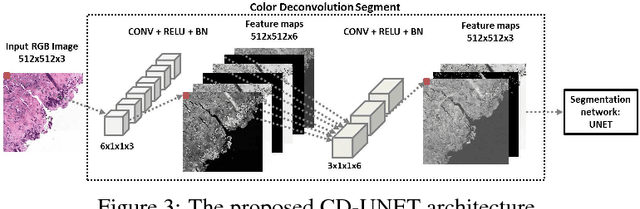Figure 4 for Generalizing multistain immunohistochemistry tissue segmentation using one-shot color deconvolution deep neural networks