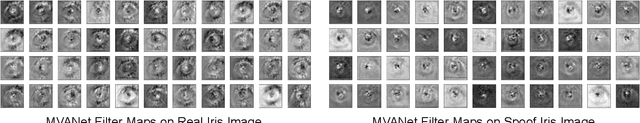 Figure 4 for Generalized Iris Presentation Attack Detection Algorithm under Cross-Database Settings