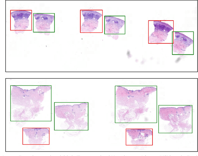 Figure 3 for Deeply supervised UNet for semantic segmentation to assist dermatopathological assessment of Basal Cell Carcinoma (BCC)