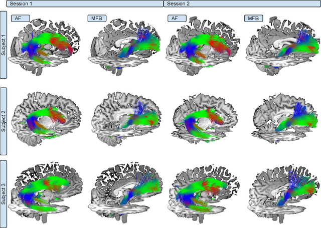 Figure 3 for HAMLET: Hierarchical Harmonic Filters for Learning Tracts from Diffusion MRI
