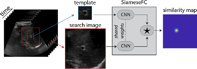 Figure 1 for Siamese Networks with Location Prior for Landmark Tracking in Liver Ultrasound Sequences