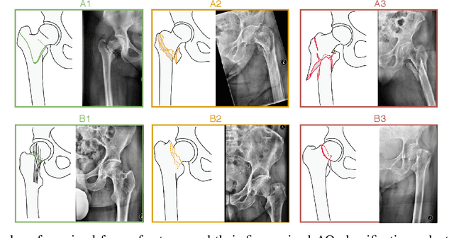 Figure 2 for Curriculum learning for annotation-efficient medical image analysis: scheduling data with prior knowledge and uncertainty