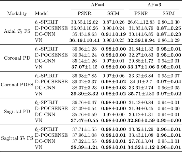 Figure 2 for Data consistency networks for (calibration-less) accelerated parallel MR image reconstruction