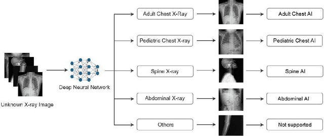 Figure 2 for DICOM Imaging Router: An Open Deep Learning Framework for Classification of Body Parts from DICOM X-ray Scans