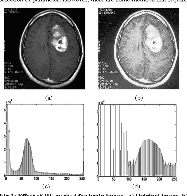 Figure 1 for Iterative Thresholded Bi-Histogram Equalization for Medical Image Enhancement