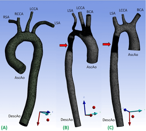 Figure 1 for 4DFlowNet: Super-Resolution 4D Flow MRI using Deep Learning and Computational Fluid Dynamics