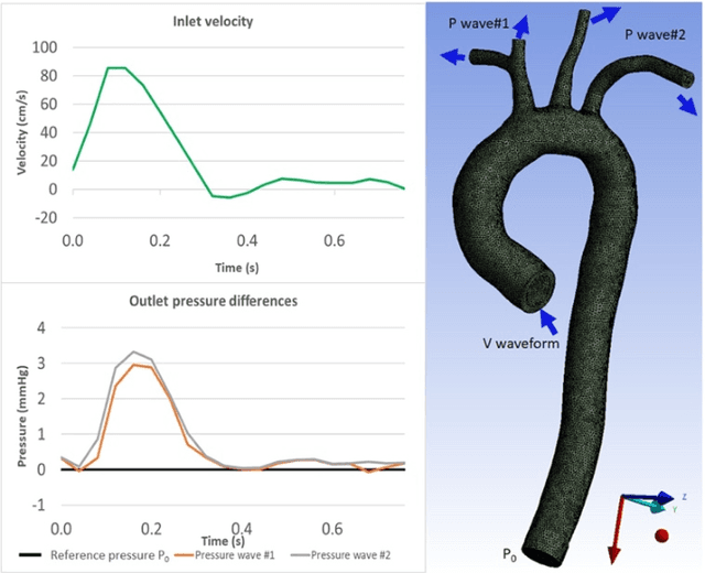 Figure 3 for 4DFlowNet: Super-Resolution 4D Flow MRI using Deep Learning and Computational Fluid Dynamics