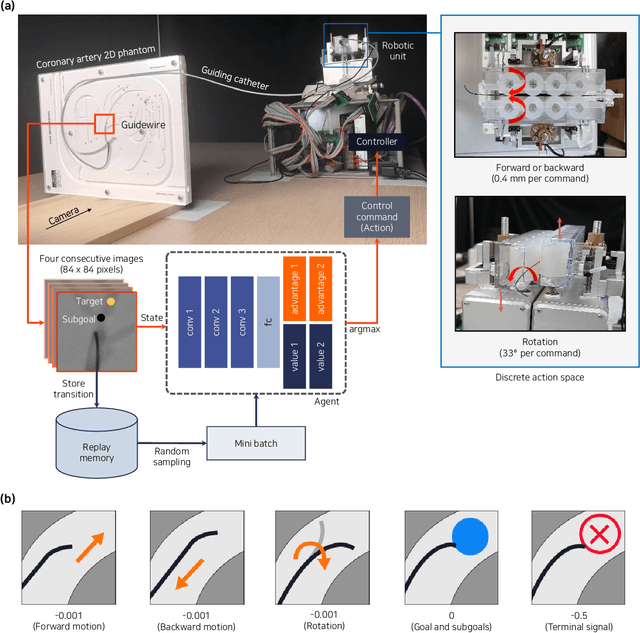Figure 1 for Deep reinforcement learning for guidewire navigation in coronary artery phantom