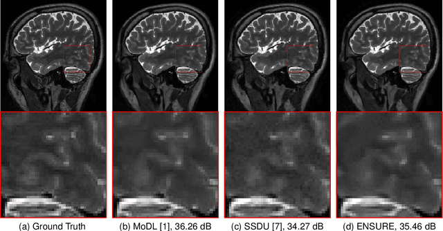 Figure 3 for ENSURE: Ensemble Stein's Unbiased Risk Estimator for Unsupervised Learning