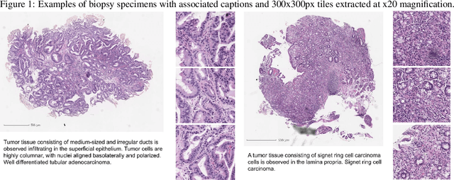 Figure 1 for Inference of captions from histopathological patches