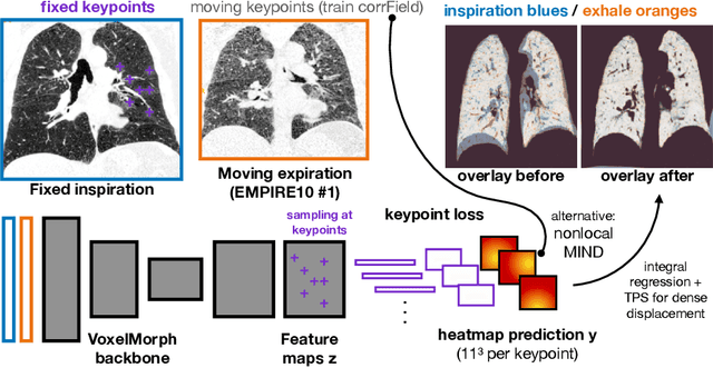 Figure 1 for Voxelmorph++ Going beyond the cranial vault with keypoint supervision and multi-channel instance optimisation