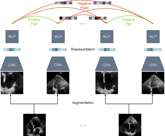 Figure 1 for Is Contrastive Learning Suitable for Left Ventricular Segmentation in Echocardiographic Images?