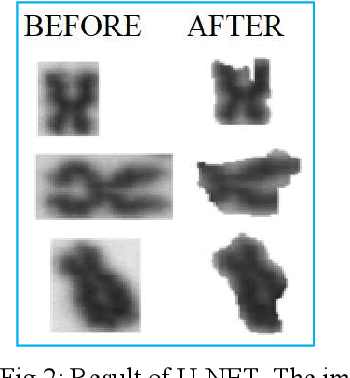 Figure 2 for Deep Learning based Automatic Detection of Dicentric Chromosome