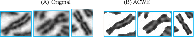 Figure 4 for Deep Learning based Automatic Detection of Dicentric Chromosome