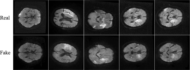 Figure 2 for CT-To-MR Conditional Generative Adversarial Networks for Ischemic Stroke Lesion Segmentation