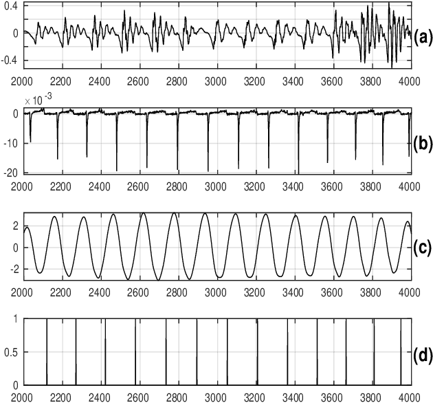 Figure 3 for Pitch-Synchronous Single Frequency Filtering Spectrogram for Speech Emotion Recognition