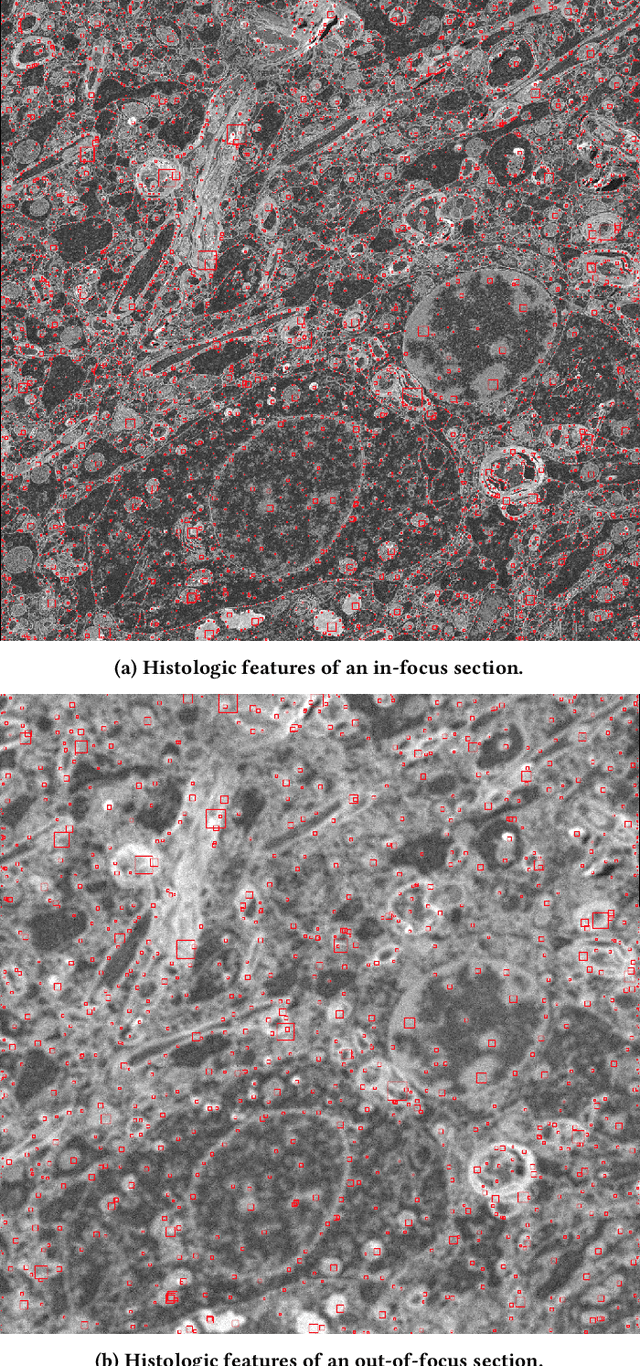 Figure 1 for Ultrafast Focus Detection for Automated Microscopy