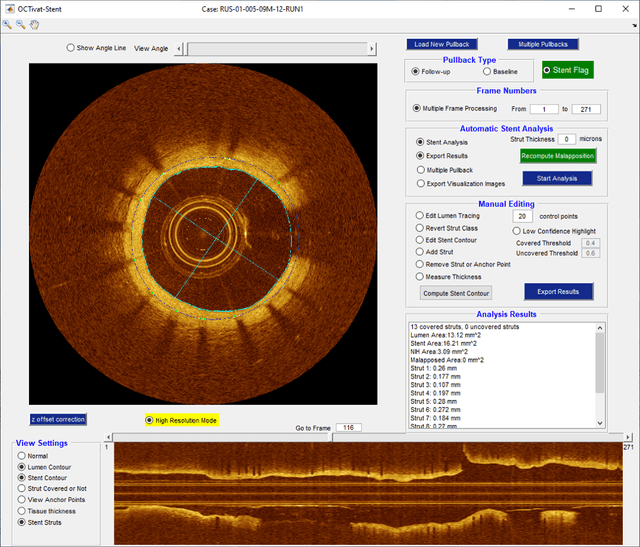 Figure 4 for OCTOPUS -- optical coherence tomography plaque and stent analysis software