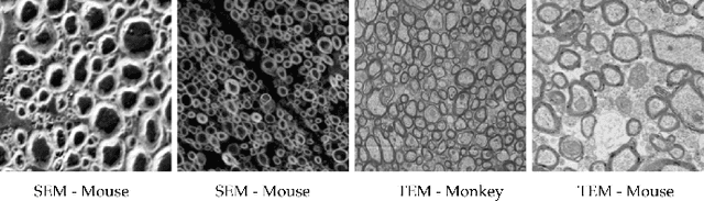 Figure 1 for Deep Active Learning for Axon-Myelin Segmentation on Histology Data