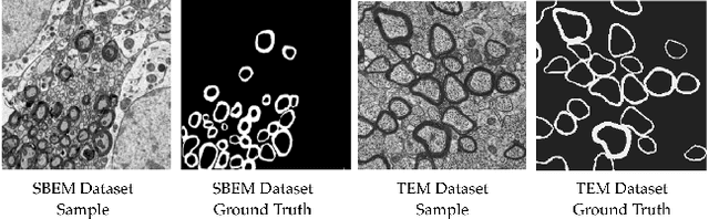 Figure 4 for Deep Active Learning for Axon-Myelin Segmentation on Histology Data