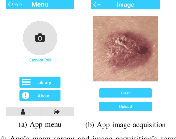 Figure 4 for A Smartphone based Application for Skin Cancer Classification Using Deep Learning with Clinical Images and Lesion Information