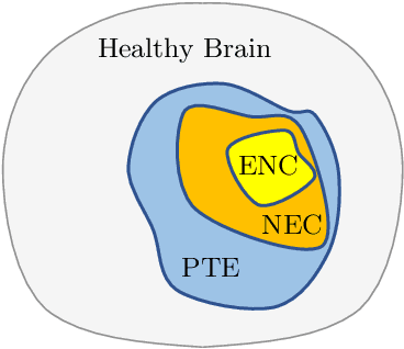 Figure 1 for E1D3 U-Net for Brain Tumor Segmentation: Submission to the RSNA-ASNR-MICCAI BraTS 2021 Challenge