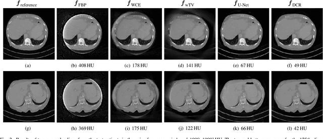 Figure 2 for Data Consistent CT Reconstruction from Insufficient Data with Learned Prior Images