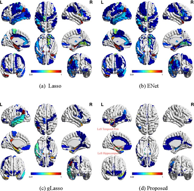 Figure 4 for Tensor-Based Multi-Modality Feature Selection and Regression for Alzheimer's Disease Diagnosis