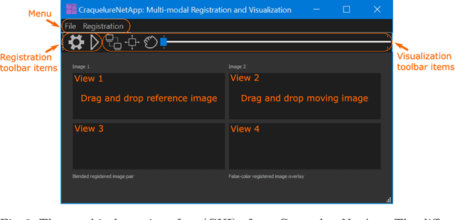 Figure 3 for A Multi-modal Registration and Visualization Software Tool for Artworks using CraquelureNet