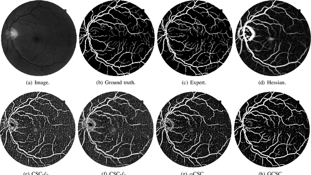 Figure 2 for General Convolutional Sparse Coding with Unknown Noise