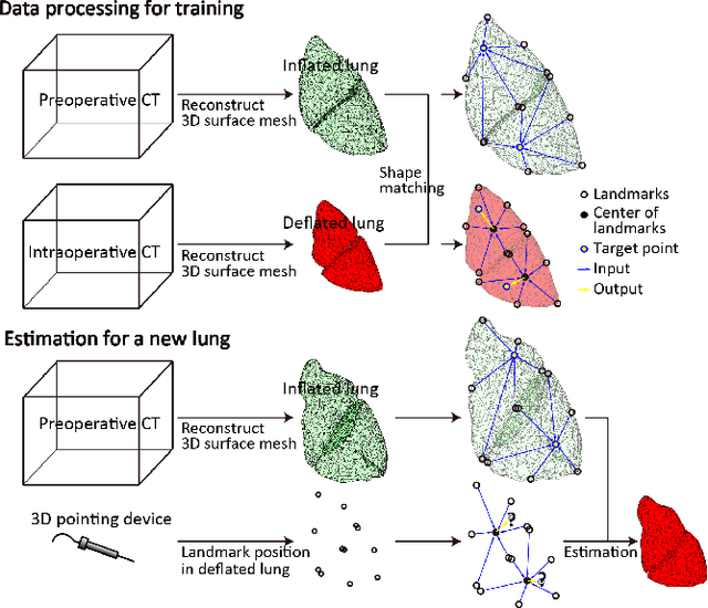 Figure 1 for Kernel-based framework to estimate deformations of pneumothorax lung using relative position of anatomical landmarks